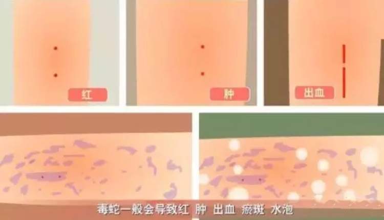 蕲蛇生活方式_蕲蛇酒的功效_啥叫生活方式